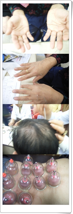 손바닥이 고슴도치같아요...